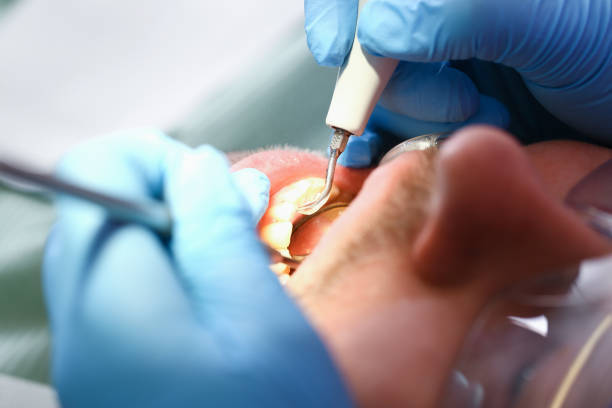 Best Pediatric Emergency Dentist in Dupont, PA