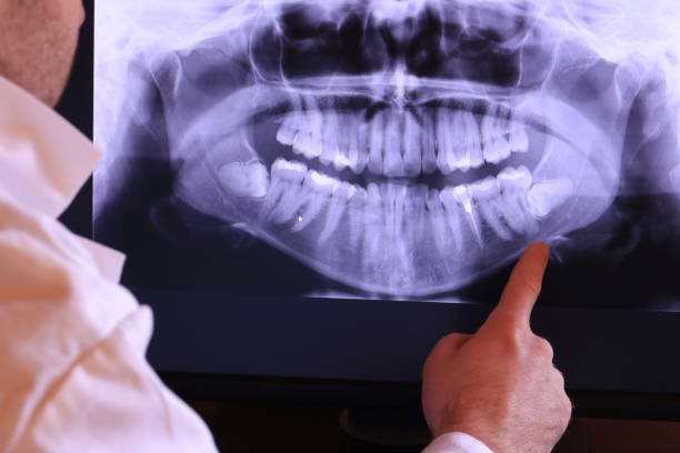 Best Emergency Dentist for Lost Fillings or Crowns in Dupont, PA